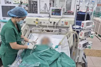 Viên sỏi 3mm gây sốc nhiễm khuẩn, bệnh nhân phải lọc máu khẩn