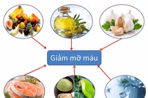 U40–U50 ăn ít thịt mỡ nhưng mỡ máu vẫn cao: 5 thói quen cần sửa