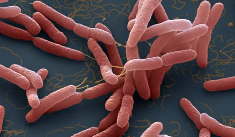 Ảnh hiển vi điện tử có màu của vi khuẩn Burkholderia pseudomallei. Ảnh: Eye of Science