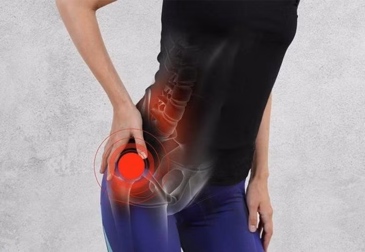 Đau dây thần kinh tọa gây ảnh hưởng đến cuộc sống hằng ngày của người bệnh/Ảnh minh họa/Internet