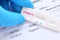 Hà Nội ghi nhận số ca Covid-19, sốt xuất huyết, tay chân miệng tăng cao