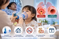 Phụ huynh cần hiểu đúng về điều trị hen phế quản cho trẻ
