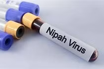 Tăng cường bảo đảm an toàn thực phẩm trong phòng, chống bệnh do virus Nipah