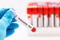 Nguy cơ cao từ gen bệnh thalassemia tại Việt Nam, cần tăng cường sàng lọc