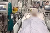 Cứu sống người bệnh viêm cơ tim cấp nguy kịch bằng ECMO