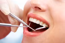 Phẫu thuật thành công cho một phụ nữ bị răng mọc lạc chỗ trong xoang trán