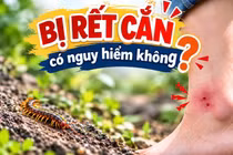 Bác sĩ hướng dẫn sơ cứu khi bị rết cắn để hạn chế nguy hiểm