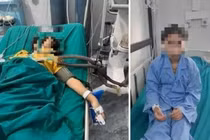 Cảnh báo về nguy cơ ngộ độc thực phẩm từ nguyên liệu tự nhiên