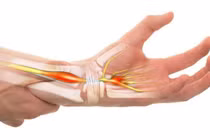 Nhận biết dấu hiệu hội chứng ống cổ tay để phòng tránh tổn thương