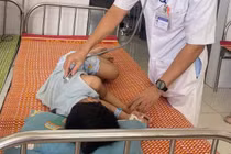 Hàng chục người nhập viện sau nghi ngộ độc bánh mì ở Đà Nẵng