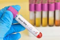 WHO cảnh báo tăng ca nhiễm virus Tây sông Nile ở châu Âu