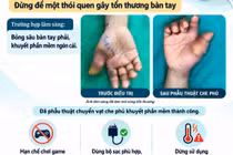 Bệnh nhân bỏng sâu bàn tay do điện thoại nổ khi sạc