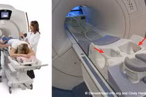 Công nghệ AI cải tiến chẩn đoán ung thư bằng MRI nhanh hơn, chính xác hơn