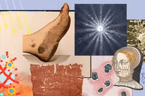 Công nghệ nano kích hoạt ánh sáng giúp điều trị vết thương mãn tính hiệu quả