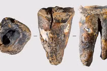 Răng người Neanderthal 60.000 năm tuổi hé lộ bí mật y học cổ đại