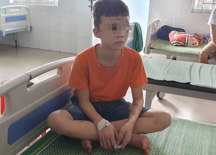 Nữ chủ quán bánh xèo đánh nhân viên bằng chày đá, dao, bàn chải sắt - 1