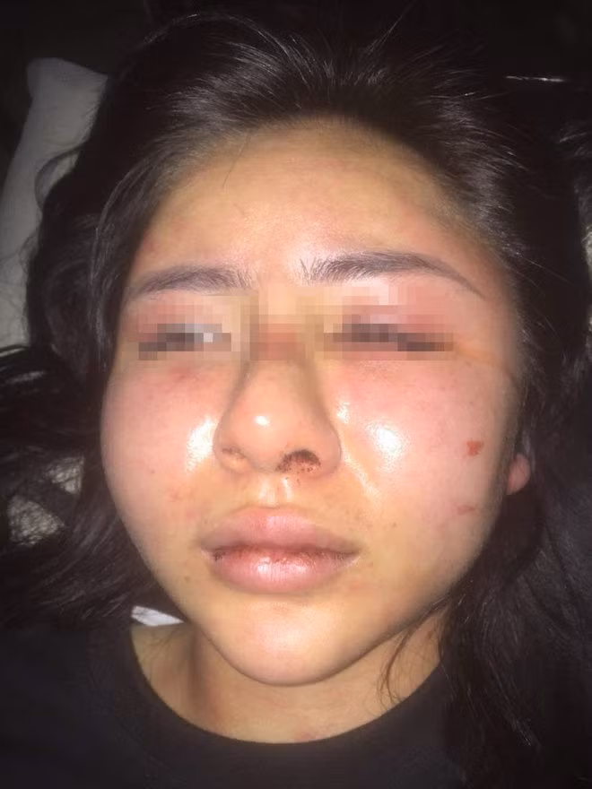 Thanh nien danh co gai vi ghen anh 1