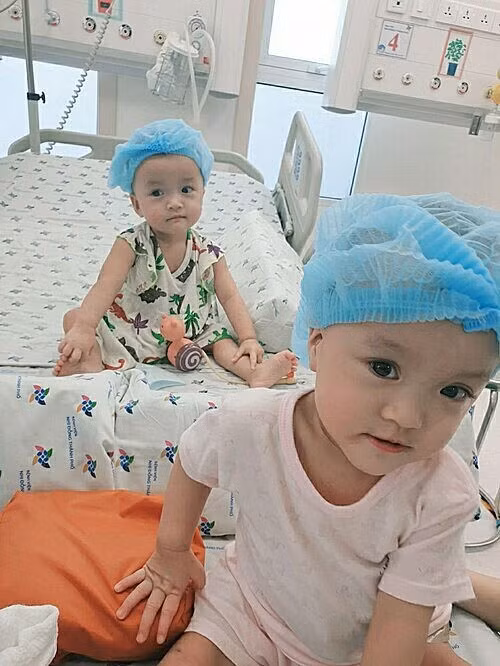 Trúc Nhi (phía trước) và Diệu Nhi được về chung giường sau thời gian dài xa cách chống nhiễm khuẩn hậu phẫu. Ảnh: Bệnh viện cung cấp.