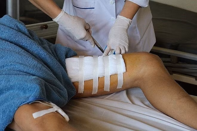 Bình rượu phát nổ, người đàn ông bị đứt cơ chân và động mạch - ảnh 1