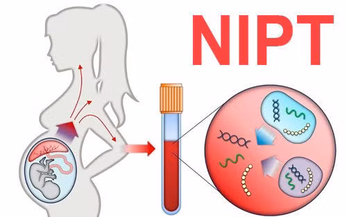 xn-nipt.jpg