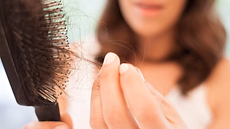 lost-hair-2.jpg
