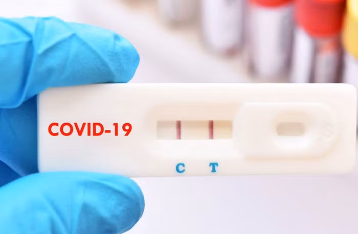 Lam gi khi ket qua test nhanh Covid-19 duong tinh? hinh anh