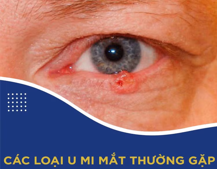 u-mi-mat.jpg
