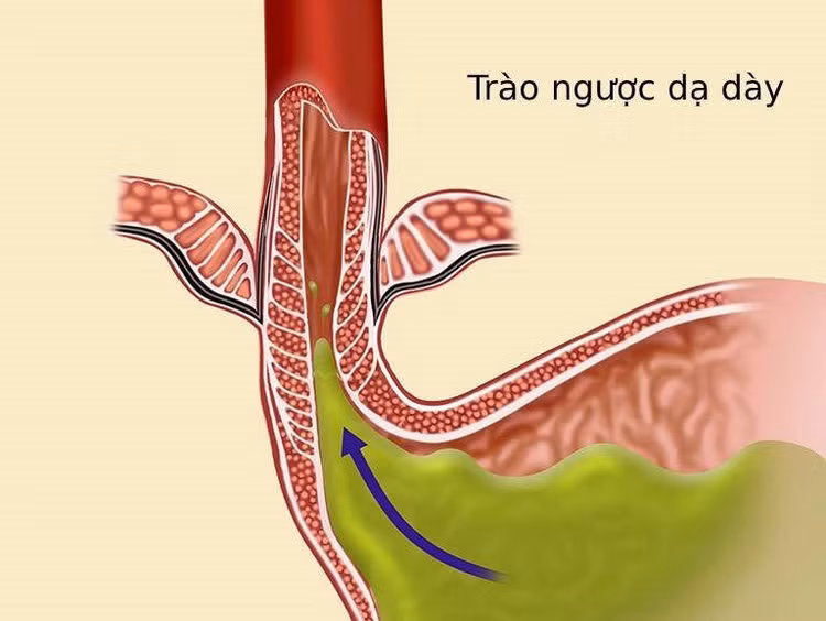 trao-nguoc.jpg