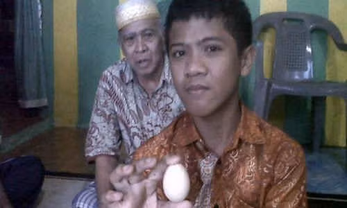cậu bé biết đẻ trứng