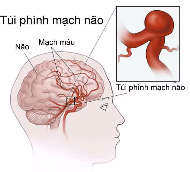 /Uploaded/khds.1cdn.vn/2018/09/16/di-dang-mach-nao1.jpg