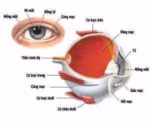 viêm dây thần kinh thị giác