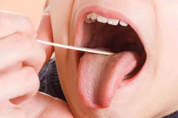 Amiđan không thể thấy viêm là muốn đi cắt