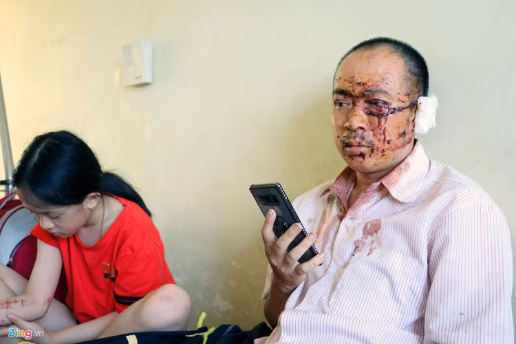 Nan nhan xe Phuong Trang: Nguoi vang khap noi, la het that thanh hinh anh 1 