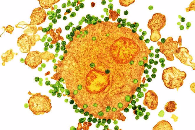Đã có bệnh nhân HIV thứ 2 trong lịch sử được chữa khỏi, mở ra chương mới cho y học - ảnh 4