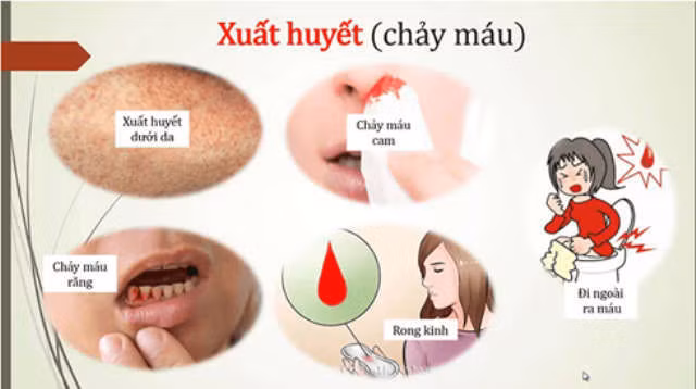 Nguy cơ bùng phát dịch sốt xuất huyết ở Hà Nội - ảnh 1