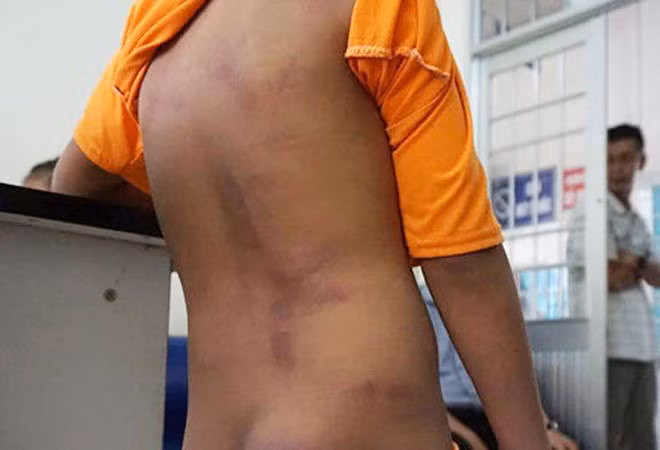 4 hoc sinh bi chi ho danh gan 250 roi, xat muoi ot vao vet thuong hinh anh 1 