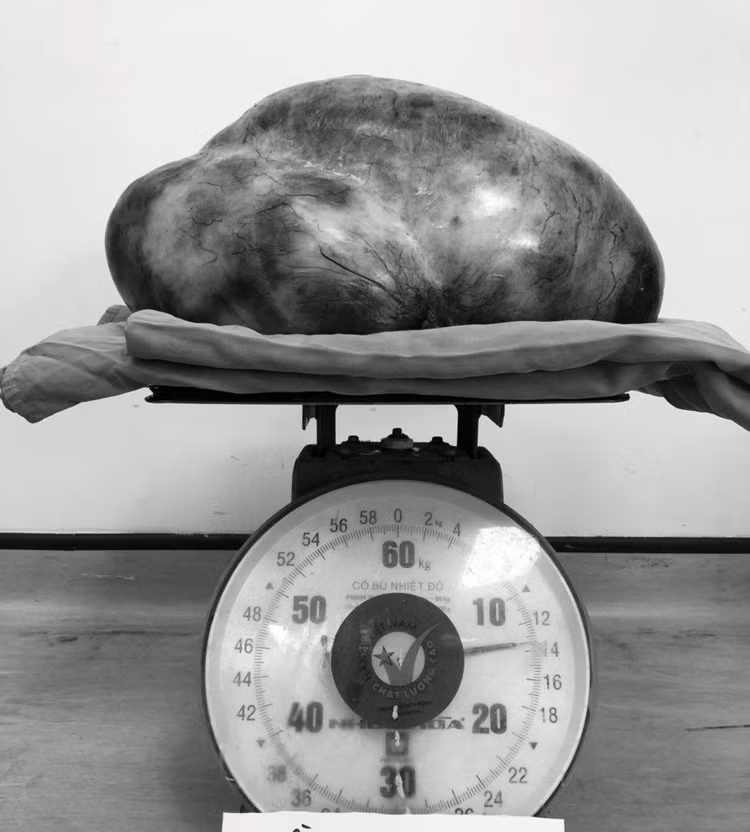 u-buong-trung-13kg.jpeg