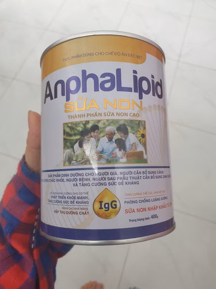 sua-non-anpha.jpg