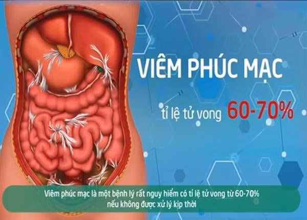 viem-phuc-mac-ruot-thua.jpg