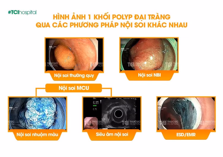noi-soi-thu-cuc-2.jpg
