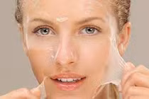 “Peel da” tại nhà cẩn thận tai biến