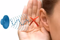  Các thuốc điều trị có thể gây điếc tai