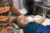 Cứu sống ngoại mục 2 trẻ nguy kịch do bệnh não hiếm gặp gây teo não