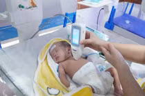 Vàng da có thể gây tổn thương não vĩnh viễn