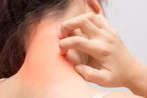 Bác sĩ mách cách phòng ngừa các bệnh da liễu trong mùa nồm ẩm