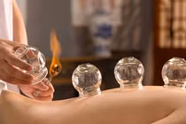 Bỏng cồn nặng vì giác hơi