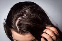 Chuyên gia mách cách xử lý tóc nhanh bết dù gội đầu thường xuyên
