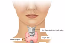 Dấu hiệu tuyến giáp có vấn đề, cần phòng tránh cho cơ thể khỏe mạnh