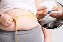 Béo phì dẫn đến đái tháo đường Type 2 ở người trẻ