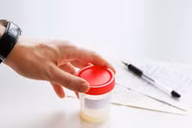 Vai trò của xét nghiệm tinh dịch đồ trong chẩn đoán vô sinh nam giới